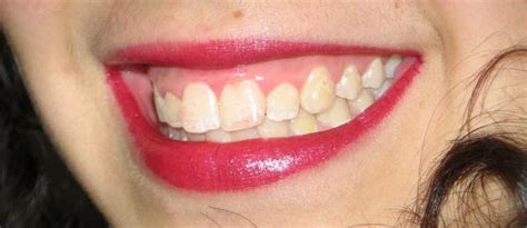 Tratamiento de la imagen: Gimp. Tu Instituto Online.