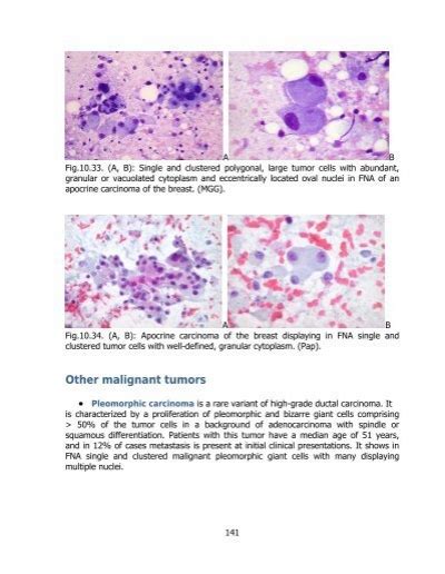 Fna Cytology • Hyperce