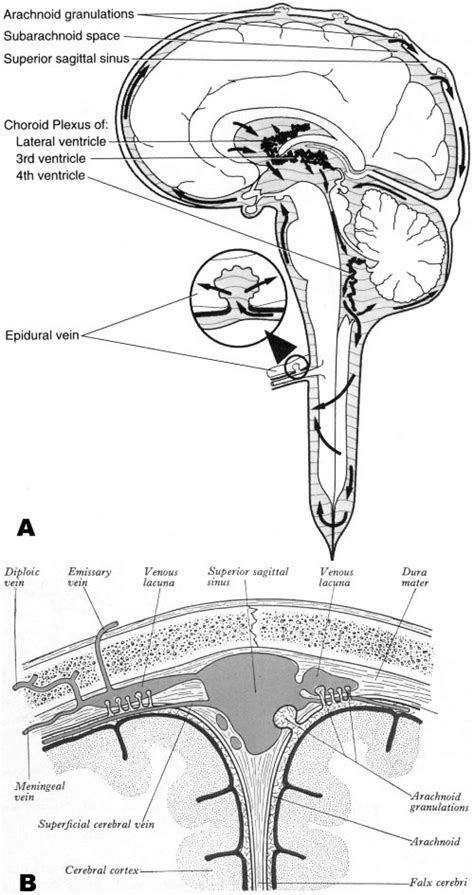 Cerebrospinal Fluid Is Produced By The Choroid Plexus In The Lateral