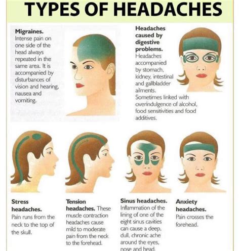 Headache Diagram Headache Diagram Causes Fix Headache Types