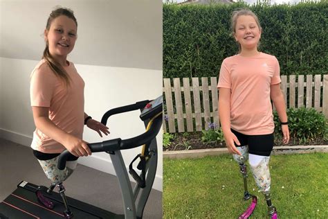 10 Year Old Amputee Raises £10000 For Charity With Lockdown Marathon