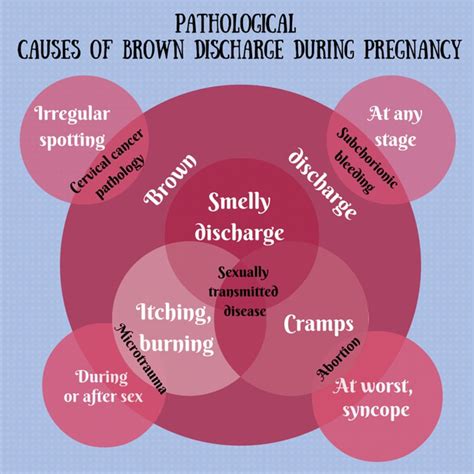 Is Brown Discharge A Sign Of Pregnancy Find Out Now All About