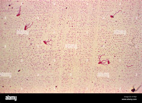 Alcaligenes Faecalis Flagella Stain Image Courtesy Cdcdr Wa