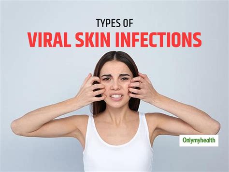 4 Types Of Viral Skin Infections And Their Characteristics For Timely