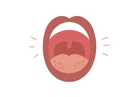 Floor Of Mouth Swelling On One Side Review Home Co