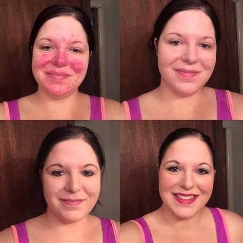 Bare Minerals Makeup For Rosacea How To Apply For Seniors Makeup