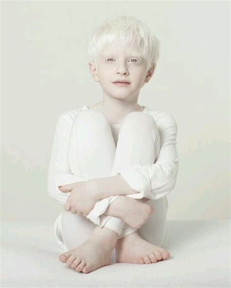 Pin Op Albinos