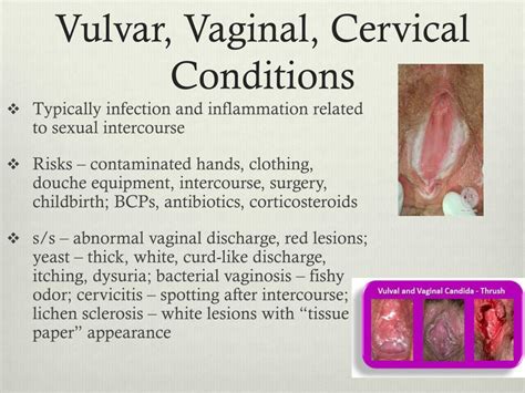 PPT Female Reproductive Disorders PowerPoint Presentation Free