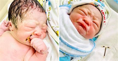 Newborn Baby Comes Out Of The Womb Holding Mom's Contraceptive IUD