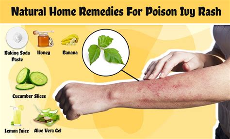 Best Way To Cure Poison Ivy Rash