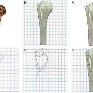 Ota Ao Classification For Proximal Humeral Fractures Fx Download Scientific Diagram