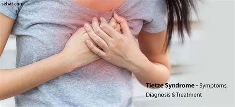 Tietze Syndrome Pictures Symptoms Diagnosis Treatment