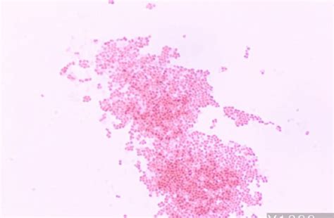 Gram Stain On Csf Showed Numerous Gram Negative Cocobacilli That Were Download Scientific