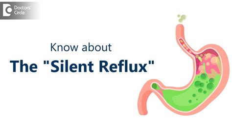 Are You Having A Silent Reflux Symptoms And Homeopathic Cure Dr