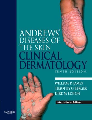 Andrews Diseases Of The Skin Clinical Dermatology By William D James