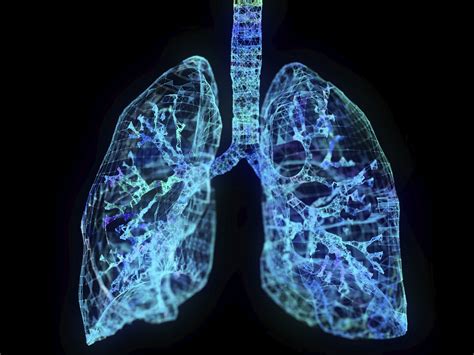 Cellular Differences In Asthma Identified In First Lung Mapping Project