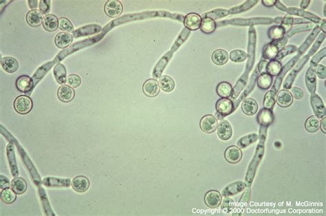 Candida Species Doctor Fungus