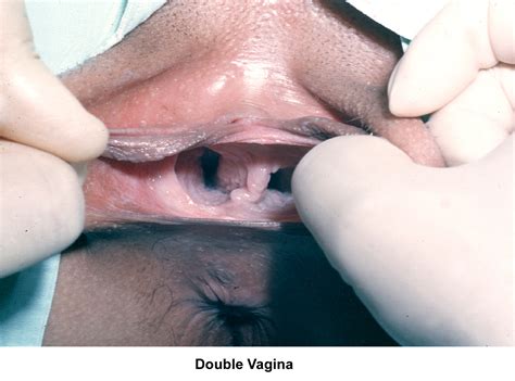 Doublevagina Best Adult Photos At Hentainudes Com