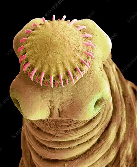 Tapeworm Cysticercus Sem Stock Image F0238526 Science Photo Library