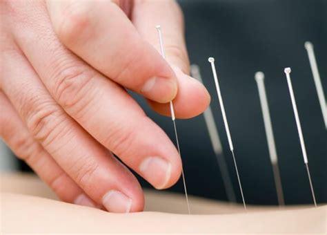 Acupuncture Therapy Promising For Parkinsons Patients