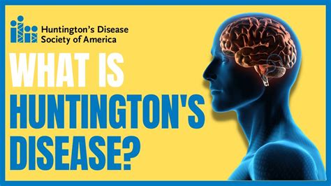 What Is Huntingtons Disease Youtube