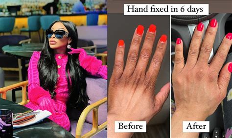 Hand Fixed In 6 Days Khanyi Mbau Lightens Her Dark Hands