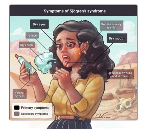 Lets Know About Primary And Secondary Sjogren Syndrome Platform Cme
