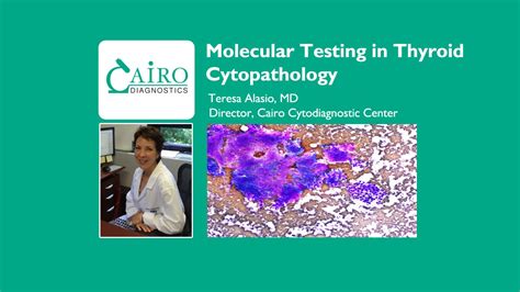 Molecular Testing In Thyroid Cytopathology Youtube