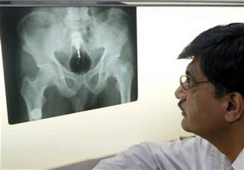 Craziest X Ray Images