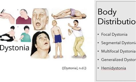 Dystonia niekontrolowane skurcze grup mięśniowych co to jest