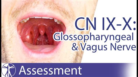 Cranial Nerve 9 And 10 Glossopharyngeal And Vagus Nerve Assessment For