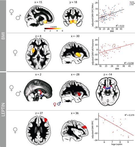 Frontiers Obesity Related Differences Between Women And Men In Brain Structure And Goal