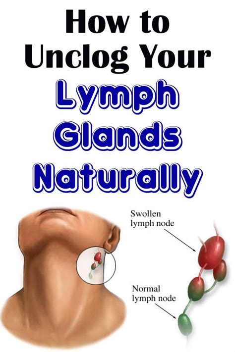 How To Unclog Your Lymph Glands Naturally In 2020 Lymph Glands