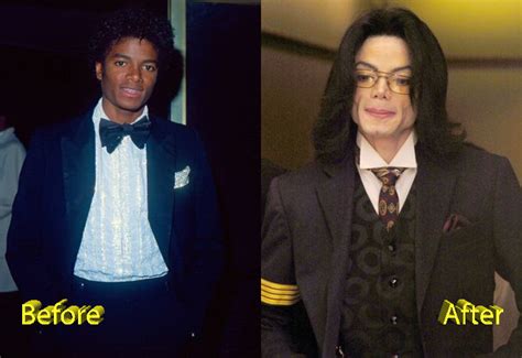 Майкл Джексон В Молодости До Операции Фото Telegraph