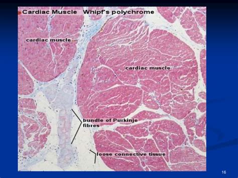Histology of cardiac muscle
