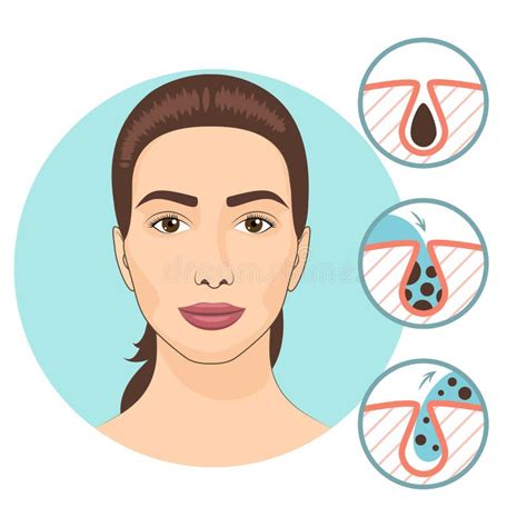 Woman Facial Treatments Skin Problems And Face Care Vector Illustration Stock Vector