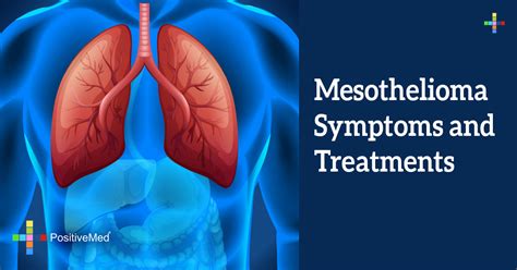 Mesothelioma Symptoms And Treatments Positivemed