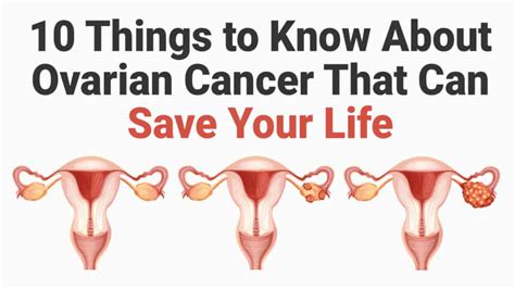 10 Things To Know About Ovarian Cancer That Can Save Your Life