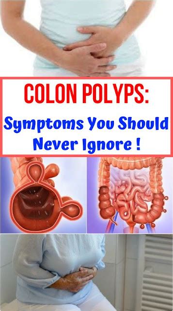 Colon Polyps Symptoms You Should Never Ignore Healthy Greens