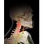 Painful Human Lymph Nodes Photograph By Sebastian Kaulitzki/science 