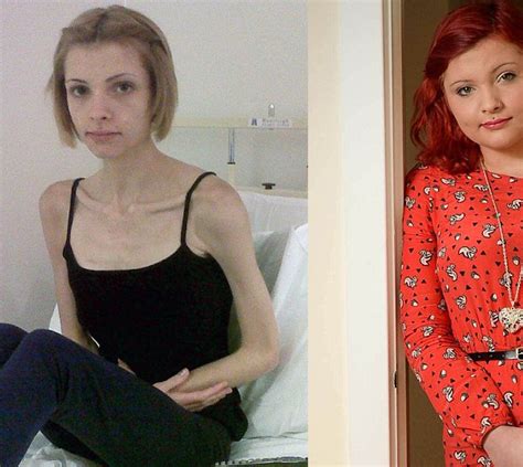 Daily Mail Online On Twitter Young Woman Makes Remarkable Recovery