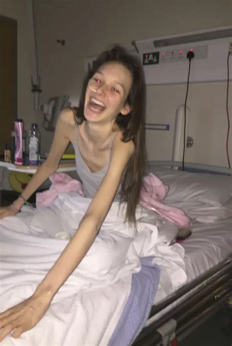 I Just Wanted To Disappear Five Stone Anorexic Teen Forced To Travel To Uk Due To Poor