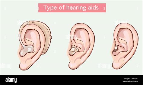 Hearing Loss Hi Res Stock Photography And Images Alamy