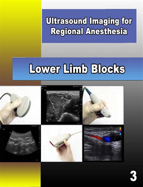 A Practical Guide To Ultrasound Imaging For Regional Anesthesia Part