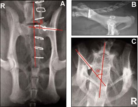 Ventral Abdominal Approach For Screw Fixation Of Sacroiliac Luxation In