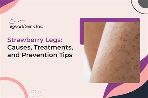 Strawberry Legs Causes Treatments And Prevention Tips