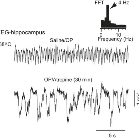 Figure S1 Op Significantly Reduced Eeg Spikes But Not Eeg Amplitudes