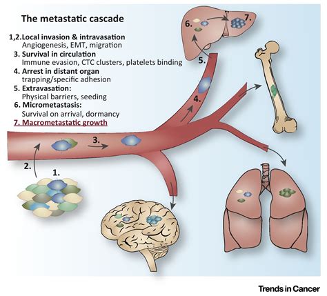 Surviving At A Distance Organ Specific Metastasis Trends In Cancer