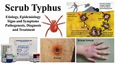 Scrub Typhus- Etiology, Epidemiology, Symptoms, Pathogenesis, Diagnosis ...