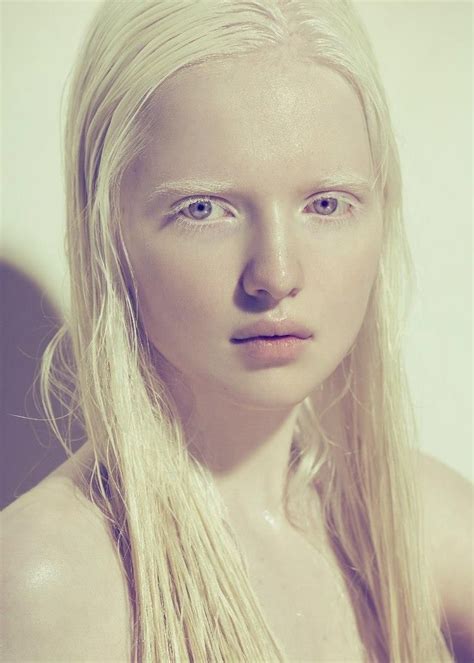 Nastya Kumarova Albino Model Albino Girl Beauty